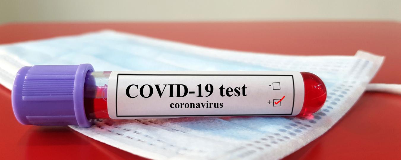 COVID-19 test tube