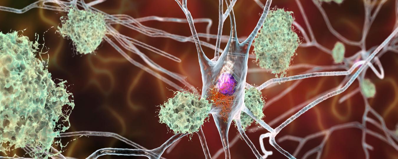 A computer illustration of senescent cells